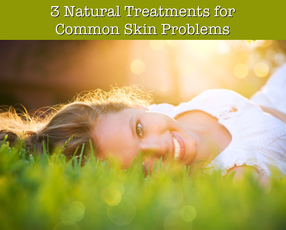 3 Natural Treatments for Common Skin Problems