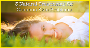 3 Natural Treatments for Skin Problems