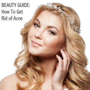 Beauty Guide - How To Get Rid of Acne
