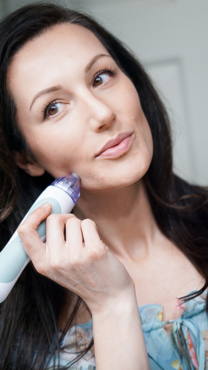 Quarantine Beauty Secrets - At-Home Skincare Tools and Laser Treatments